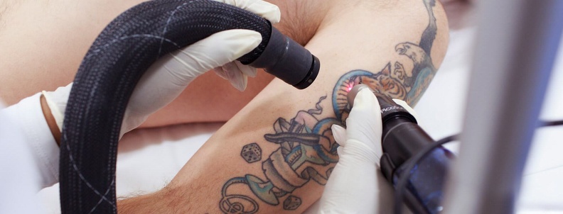 В каких случаях татуировка требует коррекции, и как этого избежать