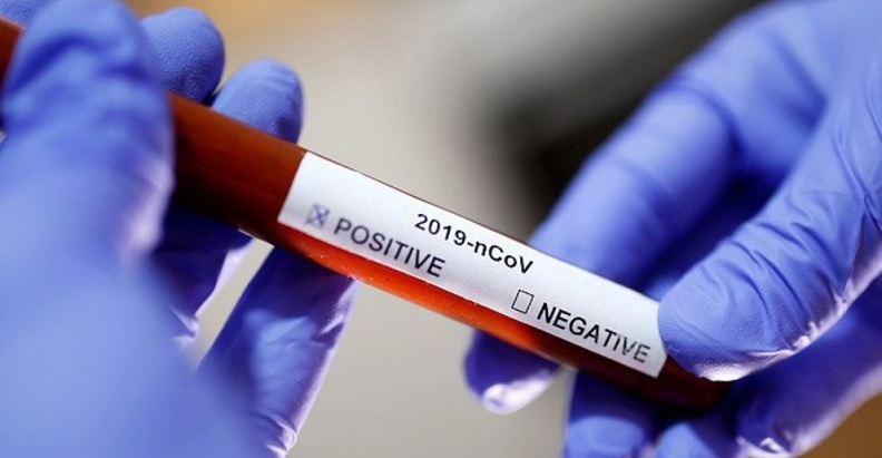 Эксперты назвали устойчивую к COVID-19 группу крови и объяснили, почему мужчины тяжелее болеют коронавирусом
