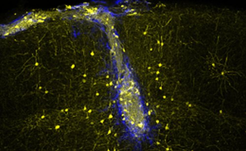 Нейроны, выращенные из эмбриональных стволовых клеток, могут заменить нейроны поврежденных областей головного мозга