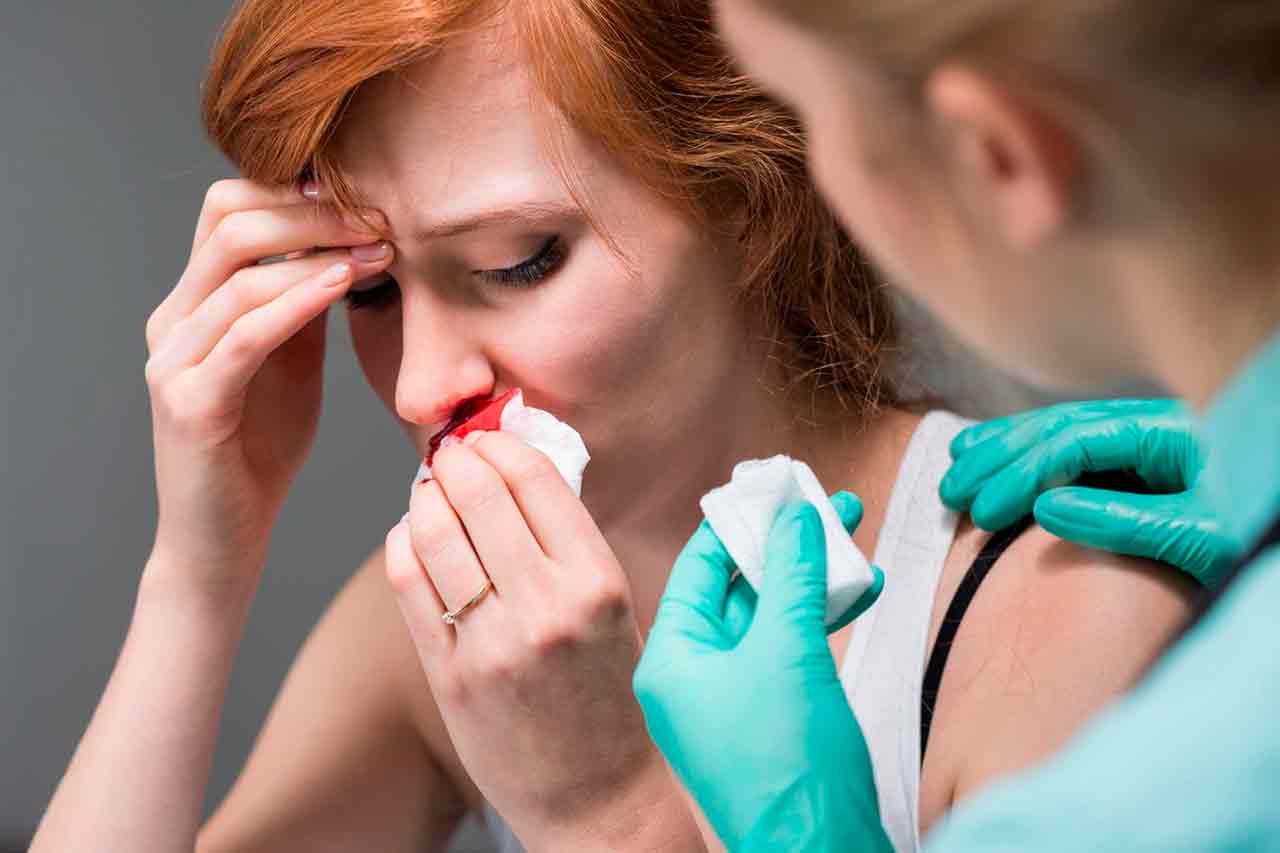 Носовые кровотечения - причины носовых кровотечений